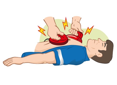Defib