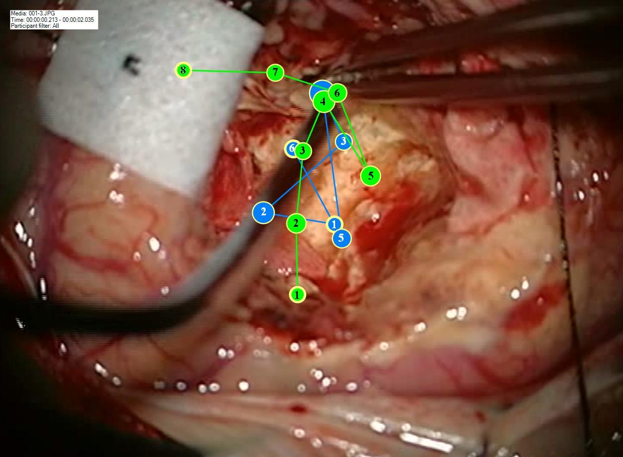 A scanpath visualization of neurosurgeons' visual attention