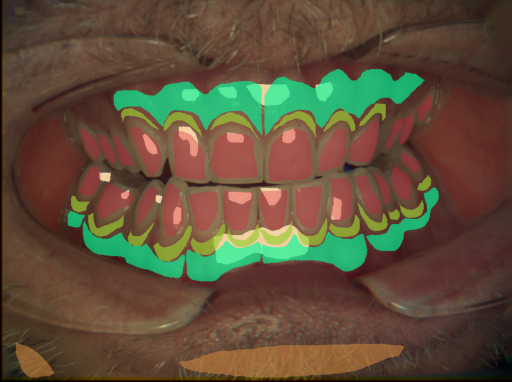 False color image render of a spectral image exhibiting attached gingiva, enamel, hair, marginal gingiva, oral mucosa and specular reflection