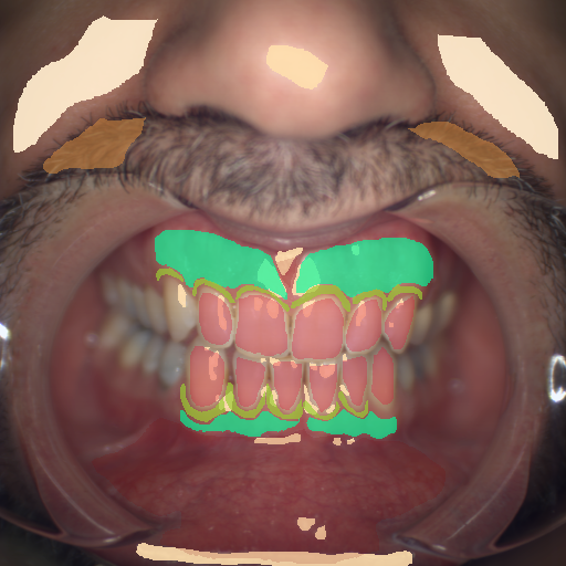 False color image render of a spectral image exhibiting attached gingiva, enamel, hair, marginal gingiva, oral mucosa, skin, specular reflection and stain