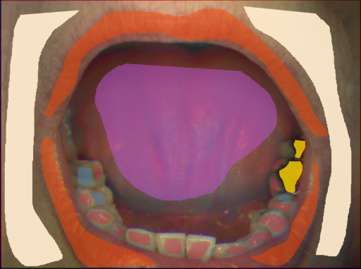 False color image render of a spectral image exhibiting enamel, lip, metal, plastic, skin and tongue