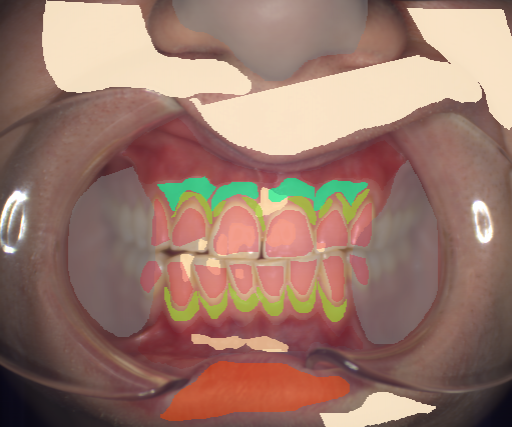 False color image render of a spectral image exhibiting attached gingiva, enamel, lip, marginal gingiva, oral mucosa, out of focus area, skin and specular reflection