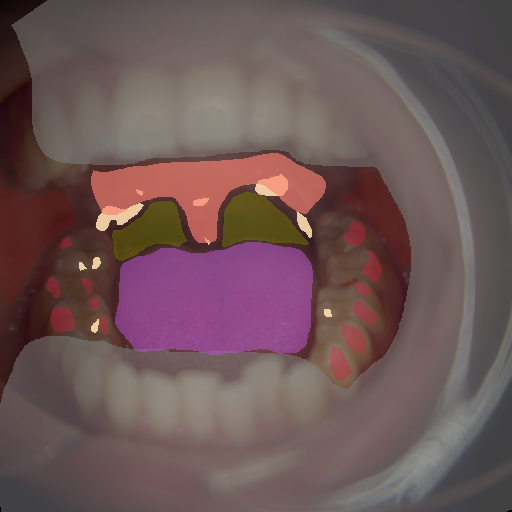 False color image render of a spectral image exhibiting enamel, oral mucosa, out of focus area, shadow/noise, soft palate, specular reflection and tongue