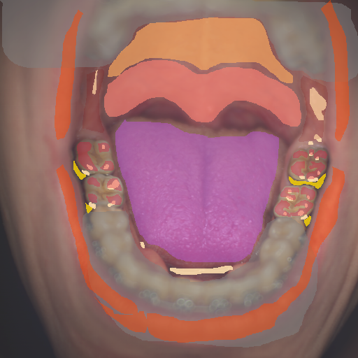 False color image render of a spectral image exhibiting enamel, hard palate, lip, metal, oral mucosa, out of focus area, soft palate, specular reflection, stain and tongue